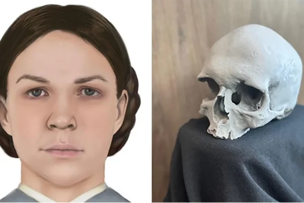 Skull Found During 1978 Home Renovation Identified as Woman Who Died 150 Years Ago
