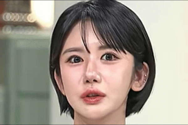 South Korean Woman Undergoes 400 Cosmetic Procedures Over 15 Years, Says She Has No Regrets